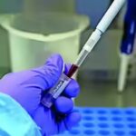 India tightens screening after 2 suspected Ebola cases surface | India News