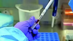 India tightens screening after 2 suspected Ebola cases surface | India News