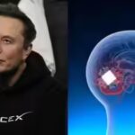 China beats Elon Musk’s ‘Jesus-level technology’ to launch world’s first commercial brain chip