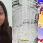 Birthday cake turns into nightmare as toddler swallows hidden metal pins | Mumbai News