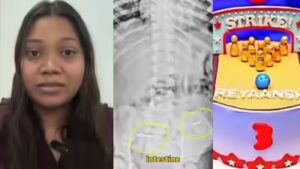 Birthday cake turns into nightmare as toddler swallows hidden metal pins | Mumbai News