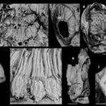 In 2022, powerful X-rays turned a tiny “human ancestor” candidate into a spiny sea creature |