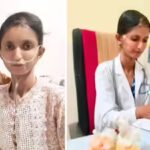 Indian Woman Fighting A Rare Disease Story: “My classmates and seniors gave me strange looks because of my appearance”: How this woman who is fighting a rare health condition became a doctor |