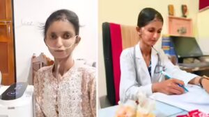 Indian Woman Fighting A Rare Disease Story: “My classmates and seniors gave me strange looks because of my appearance”: How this woman who is fighting a rare health condition became a doctor |