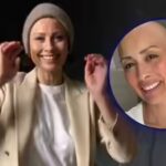 Melanie Sykes reveals her bald look, following the diagnosis of Alopecia: ‘Loss + Gain = Life |