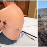 A man impales himself on trekking pole while climbing Montana’s highest peak, hikes 10 miles to safety instead of calling a helicopter